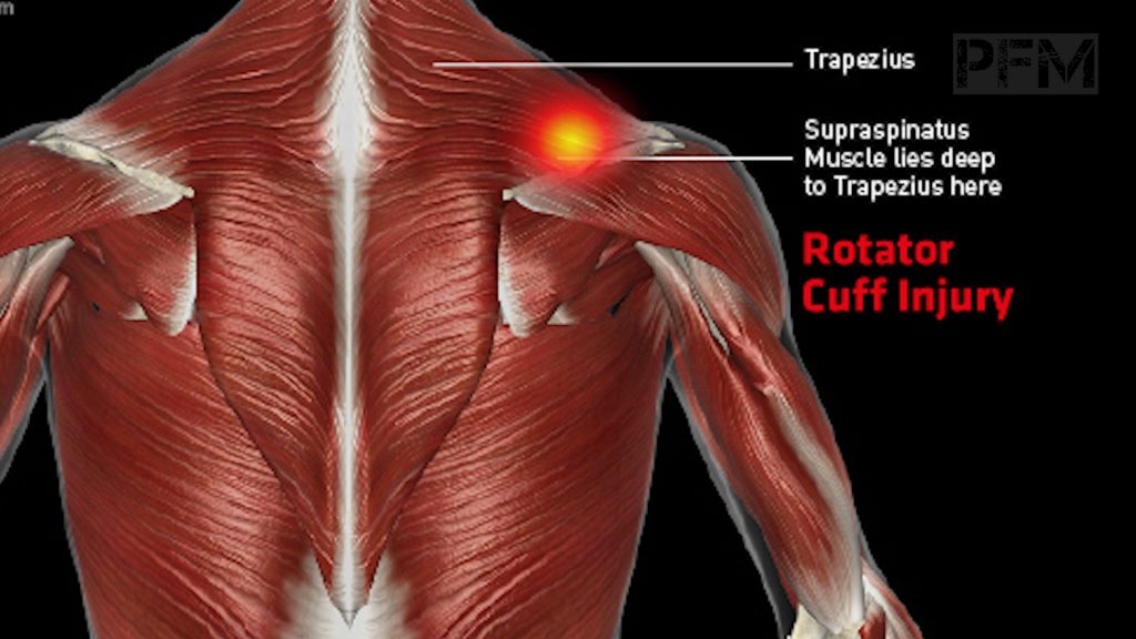 Shoulder Pain Kickboxing: Is Your Technique Causing Injury? Find Out Here!